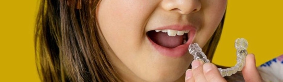 투명교정 시작하기전에 관련 이미지 14