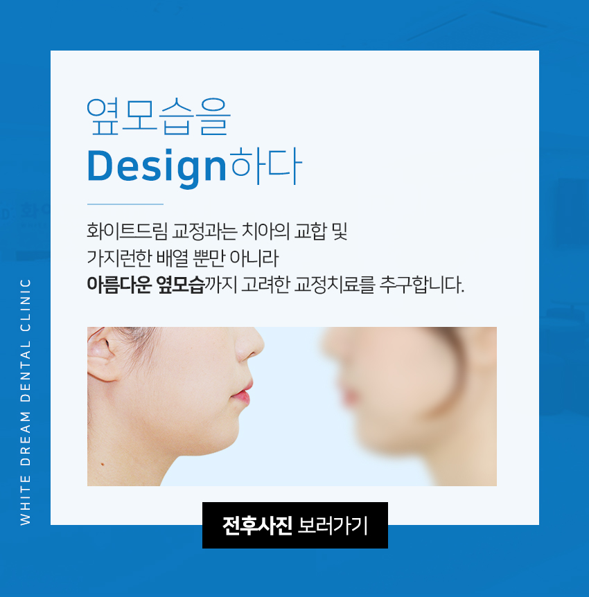 치아교정, 꼭 해야 한다면 미리 알아 두자. 관련 이미지 18