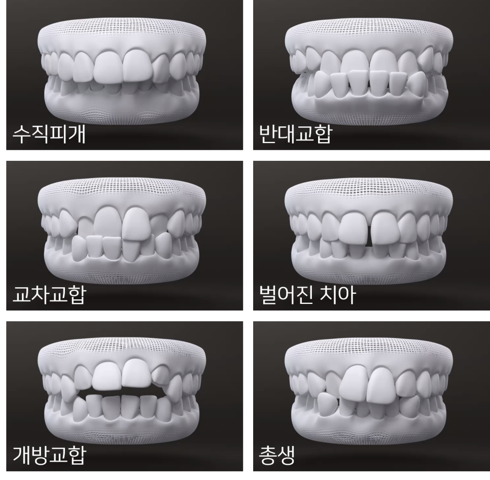 인비절라인 tmi 관련 이미지 20
