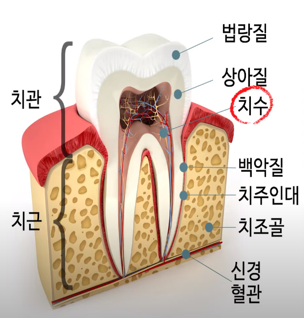 [백몽티비]신경치료 받으면 감각이 사라지나요? 관련 이미지 1