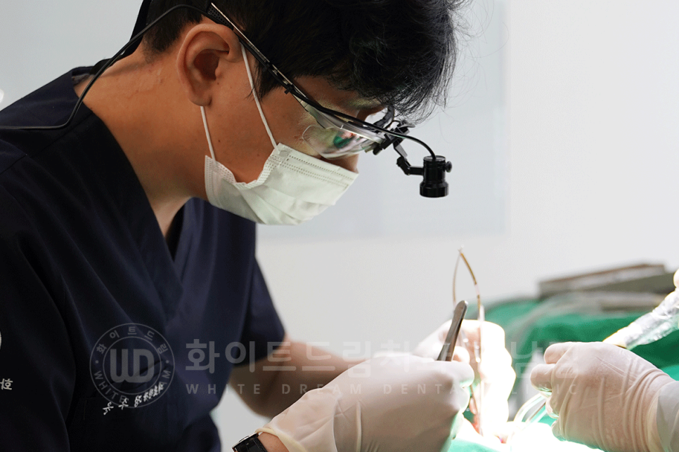 강남 덧니 비발치교정 / 임플란트와 치아교정 동시 진행 case 리뷰. 관련 이미지 13