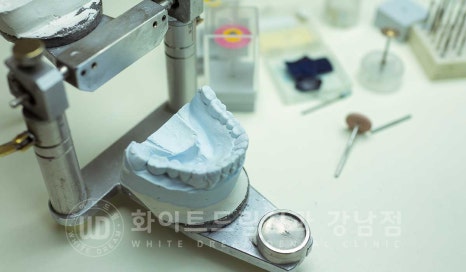 중년 앞니라미네이트 / 노화로 마모되고 누렇게 변한 치아, 어떻게 치료할까? 관련 이미지 13