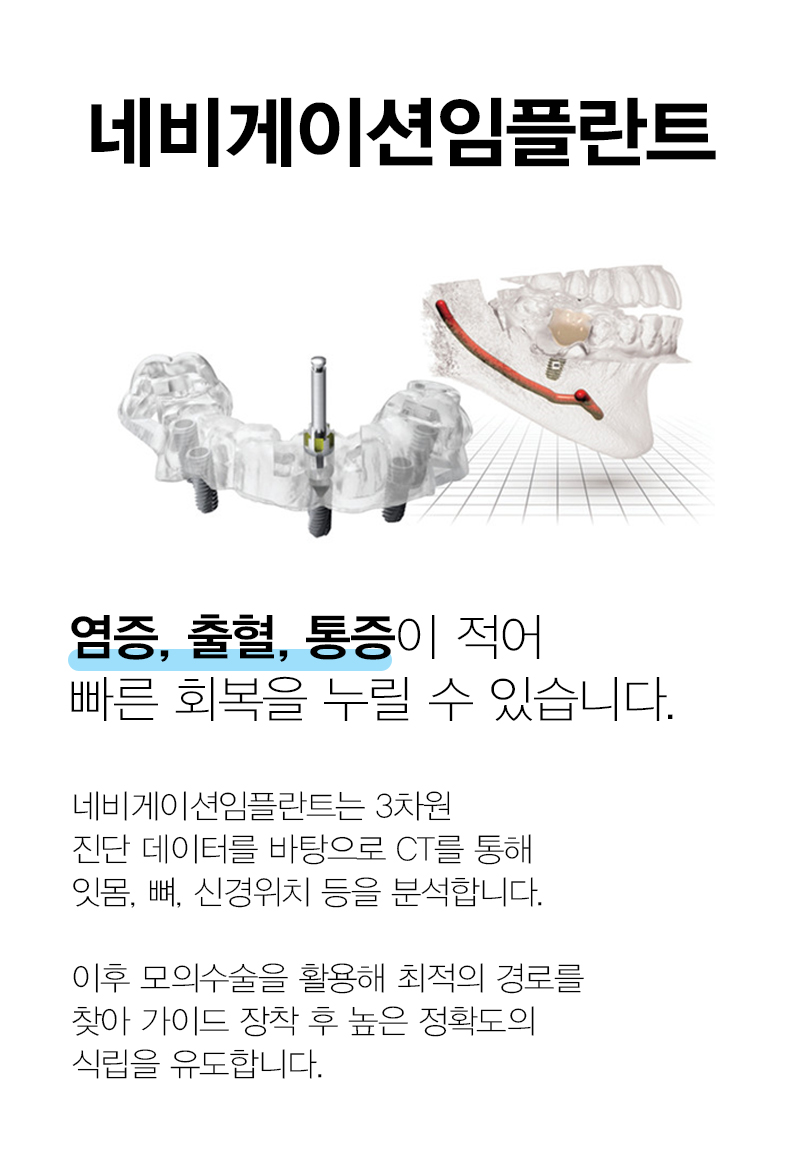 임플란트 하기 전 알아보아야 할 것. 관련 이미지 12