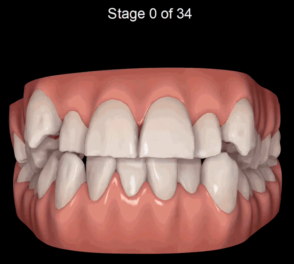 인비절라인 tmi 관련 이미지 12