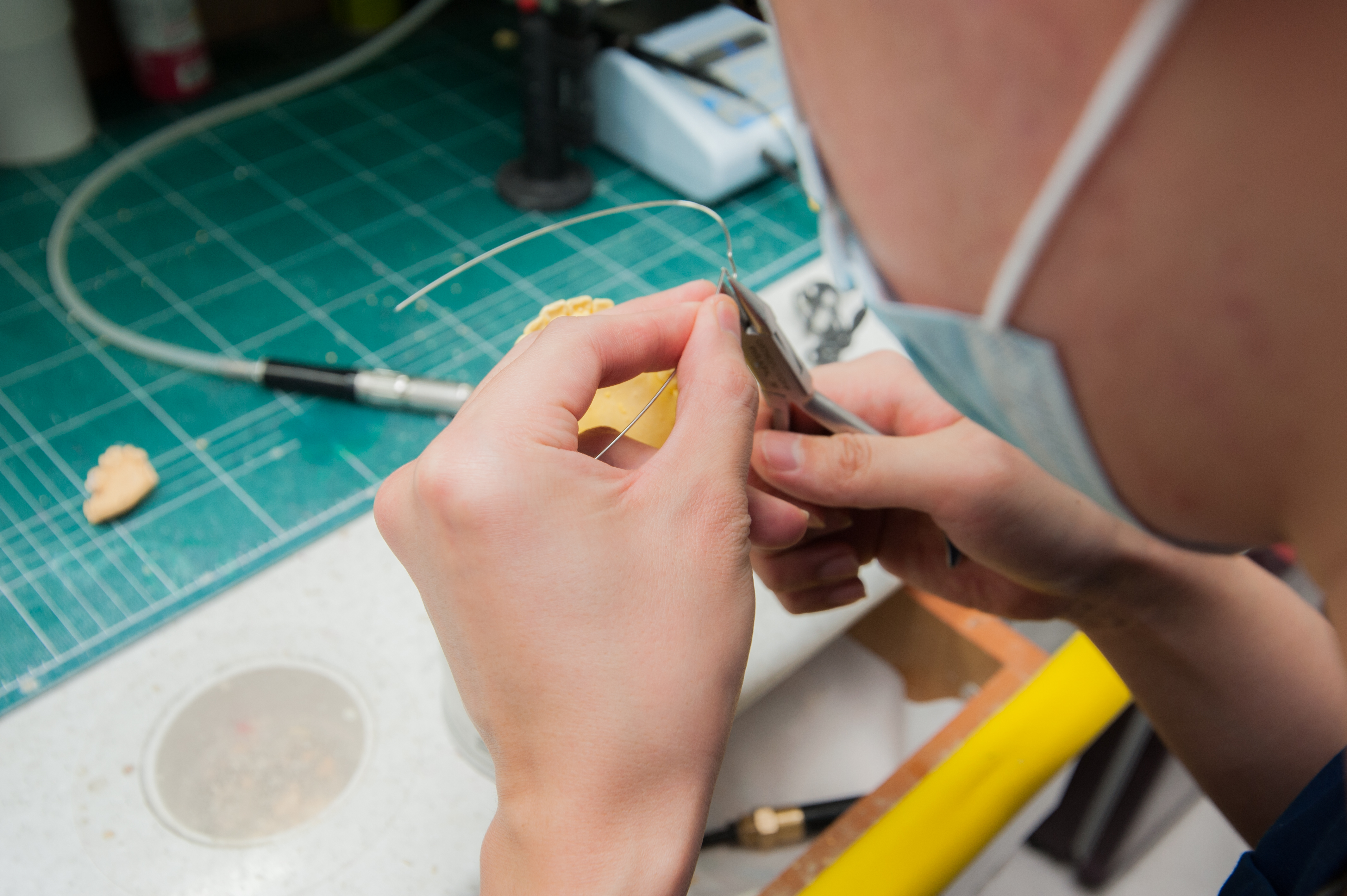 치아교정, 꼭 해야 한다면 미리 알아 두자. 관련 이미지 33