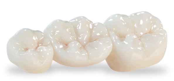 임플란트 하기 전 알아보아야 할 것. 관련 이미지 24