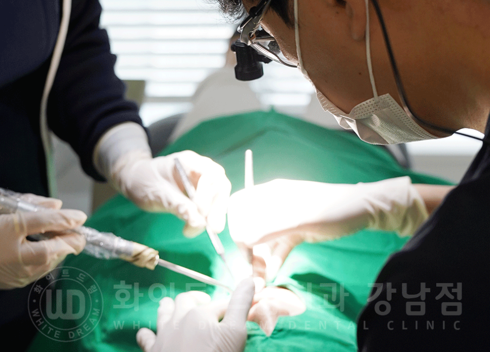 서울 전체임플란트 기간 / 전체 임플란트 7개월 완성, 무치악 임플란트 관련 이미지 18