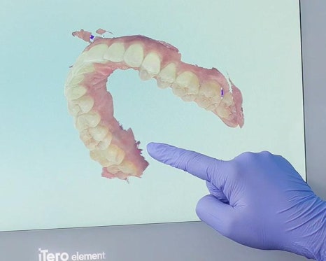 치아교정, 꼭 해야 한다면 미리 알아 두자. 관련 이미지 22