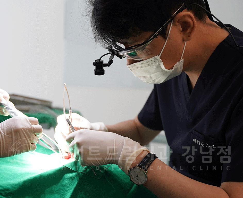 서초동 어금니 임플란트 / 강남역 화이트드림치과 : 상악동 거상술 (crestal approch) 관련 이미지 1