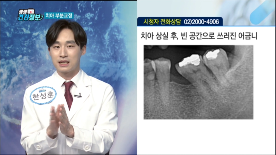 [매일경제TV 생생건강정보] 교정과 한성훈원장님 출연영상 관련 이미지 4