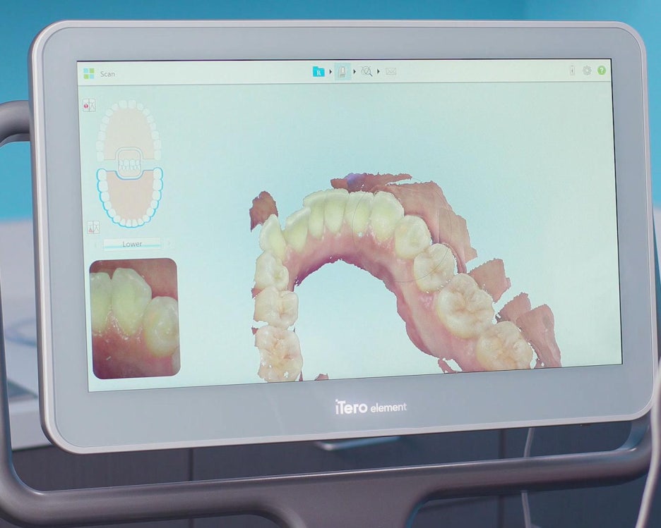 임플란트 하기 전 알아보아야 할 것. 관련 이미지 7