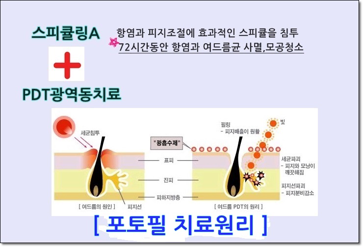 무더운 여름 피지와의 전쟁, 포토필로 피지클리어!!. 관련 이미지 3
