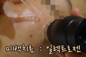 [공유] 가을은 화이트닝의 계절, 여름내 진해진 기미 치료를 위한 방법을 찾아보자! 관련 이미지 8