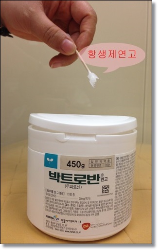 피곤하기만 하면 잡히는 입술물집(입술포진),어떻게 치료할까요? 관련 이미지 4