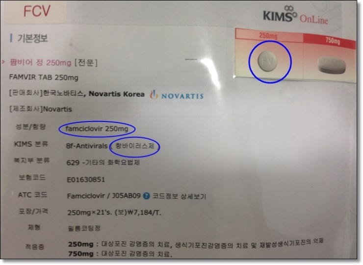 피곤하기만 하면 잡히는 입술물집(입술포진),어떻게 치료할까요? 관련 이미지 2