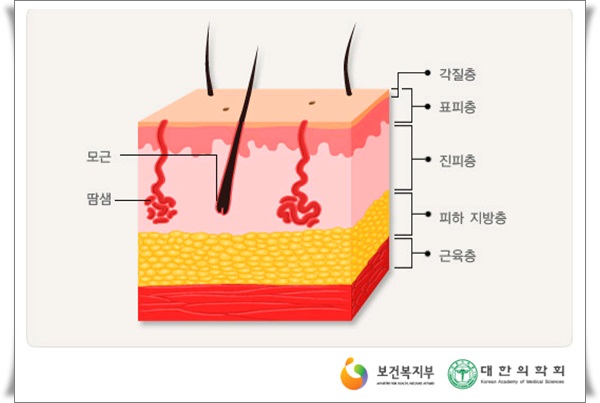 화상물집, 화상치료, 화상흉터를 최소로 남길 수 있는 방법 신촌차앤박에서 알려드릴께요!! 관련 이미지 1