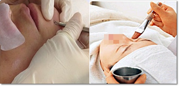 신촌피부칼럼 여름철 피부불청객 여드름치료 관련 이미지 4