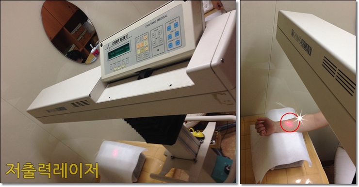 피곤하기만 하면 잡히는 입술물집(입술포진),어떻게 치료할까요? 관련 이미지 5