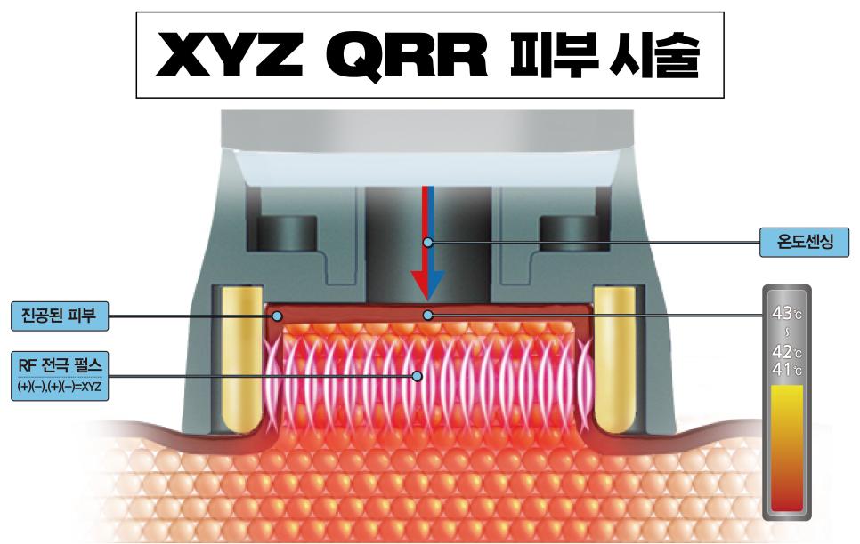 신촌차앤박 피부 칼럼 : 아프지 않는 리프팅 관련 이미지 3