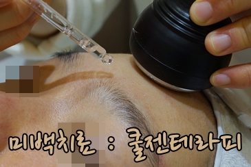 [공유] 가을은 화이트닝의 계절, 여름내 진해진 기미 치료를 위한 방법을 찾아보자! 관련 이미지 9