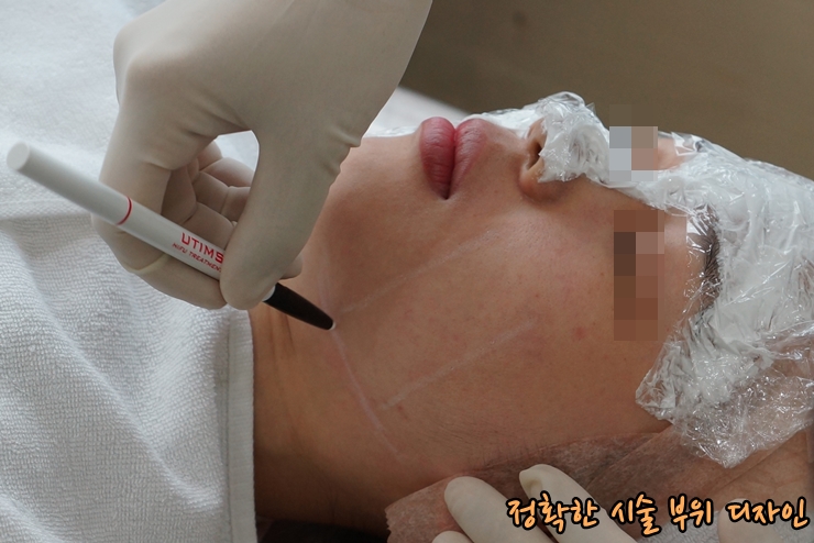 [공유] 남는 것은 사진! 활짝 웃어 보세요~ 뉴테라 리프팅으로 피부 탄력, 넓은 모공 개선하기! 관련 이미지 3