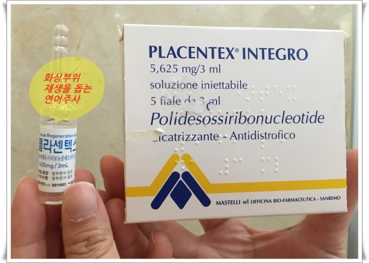 화상물집, 화상치료, 화상흉터를 최소로 남길 수 있는 방법 신촌차앤박에서 알려드릴께요!! 관련 이미지 3