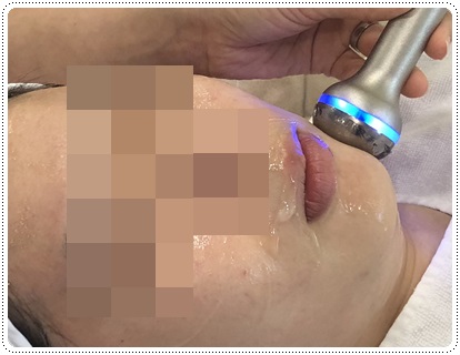 신촌피부과전문의칼럼:미세먼지로 인한 피부노화 치료 관련 이미지 5