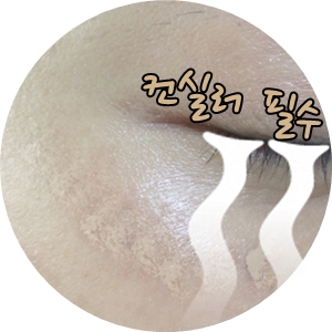 [공유] 가을은 화이트닝의 계절, 여름내 진해진 기미 치료를 위한 방법을 찾아보자! 관련 이미지 4