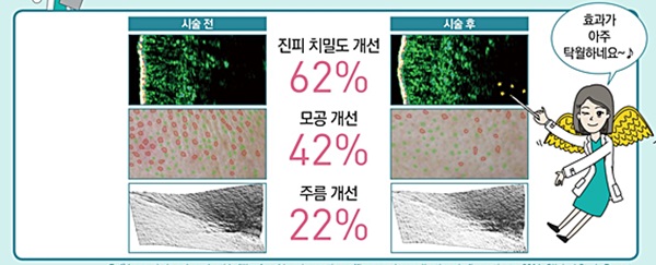 신촌차앤박피부전문의칼럼:리쥬란힐러,지치고 손상받은 피부에 쉼을 선물하세요!! 관련 이미지 3