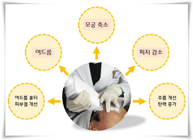 신촌차앤박 피부칼럼 : 번들번들 피지,구멍 송송 모공 관련 이미지 3