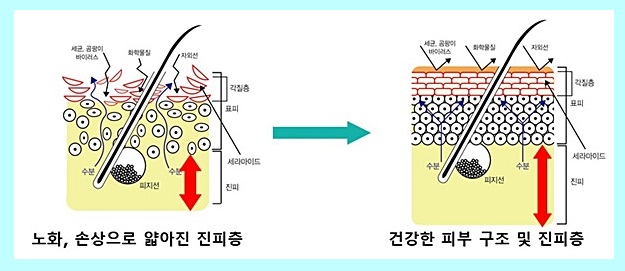 신촌차앤박피부전문의칼럼:리쥬란힐러,지치고 손상받은 피부에 쉼을 선물하세요!! 관련 이미지 2