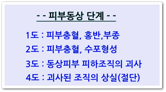 <신촌차앤박피부정보> 겨울철야외활동, 추운 겨울 겪을 수 있는 피부동상에 대해 알아보겠습니다!! 관련 이미지 4