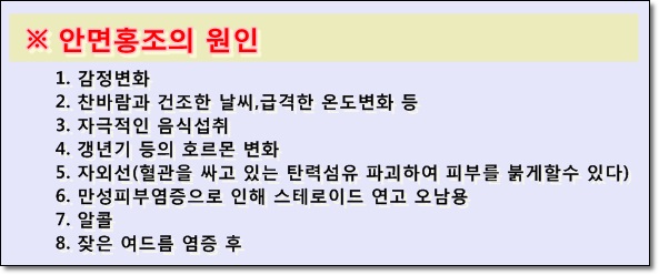 <신촌피부전문의칼럼> 시도 때도 없이 빨개지는 안면홍조...혈관레이저 치료 받고 탈출!! 관련 이미지 3