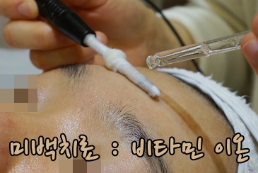 [공유] 가을은 화이트닝의 계절, 여름내 진해진 기미 치료를 위한 방법을 찾아보자! 관련 이미지 10