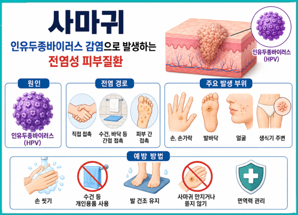 Warts in Yangcheon-gu: Why They Keep Increasing Even Though I Thought They Were Dark Spots image 2