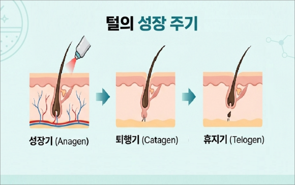 오목교제모, 기대만큼 변화가 없어 실망했다면 확인하세요 관련 이미지 3