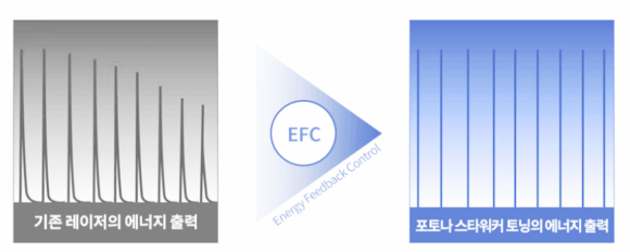 목동 레이저토닝 기미 주근깨 치료 제대로 하려면 관련 이미지 3
