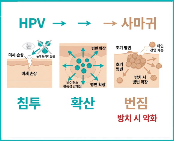 Warts in Yangcheon-gu: Why They Keep Increasing Even Though I Thought They Were Dark Spots image 3