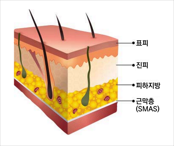 목동슈링크, 처진 피부를 고민하신다면 관련 이미지 3