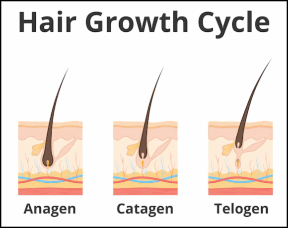 Why Does Mokdong Laser Hair Removal Require Multiple Sessions? image 6