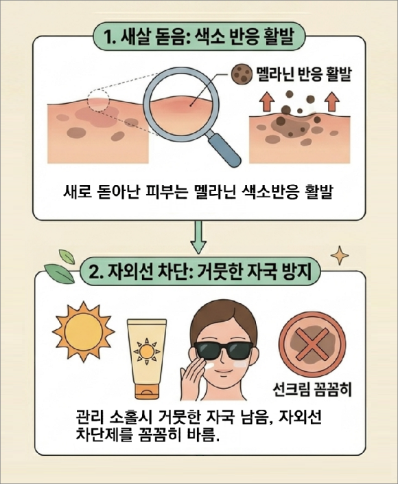 Customized Care Guide by Condition for Mole Removal in Mok-dong image 6