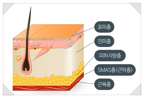 The Difference in Pico Toning Output in Mok-dong Appears “Like This” image 5