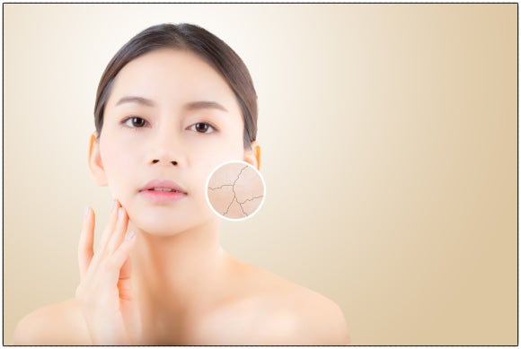 Seoul Aqua Peel: It Can Be Helpful When This Is Bothering You image 6