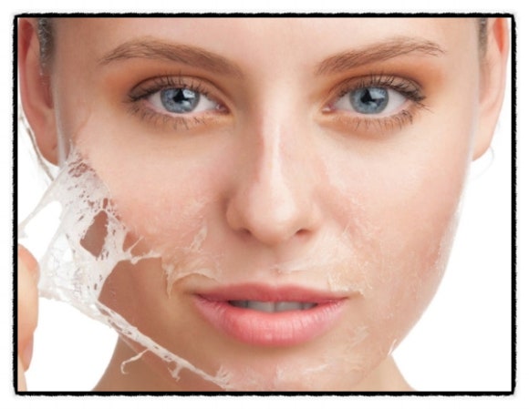 Seoul Aqua Peel: It Can Be Helpful When This Is Bothering You image 5