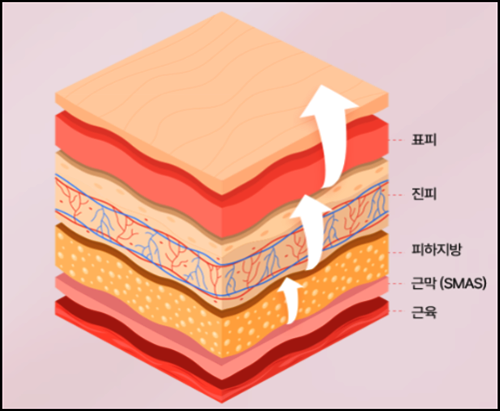 Mokdong Thermage: How Can You Get the Best Results? image 2