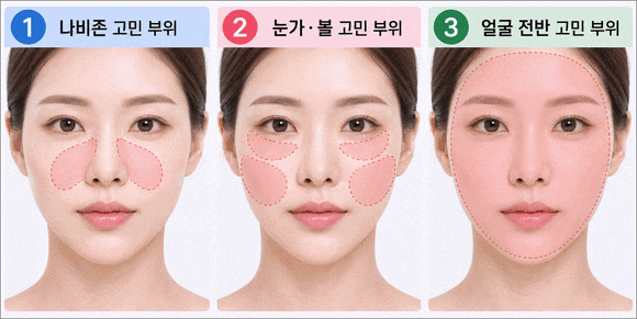 목동스킨보톡스, 내 피부에도 맞을까? 추천 타입과 시술 전 체크리스트 관련 이미지 3