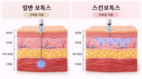 목동스킨보톡스, 내 피부에도 맞을까? 추천 타입과 시술 전 체크리스트 관련 이미지 2