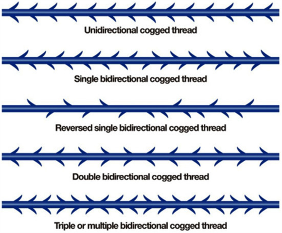 Yangcheon-gu Lifting: What Are the Differences Between Procedures That Suit My Face? image 9