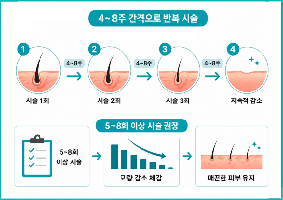 오목교제모, 정말 털이 안날까요? 효과를 좌우하는 핵심 기준 관련 이미지 3