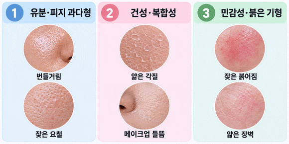 목동아쿠아필, 내 피부에도 맞을까? 효과와 시술 주기 관련 이미지 4